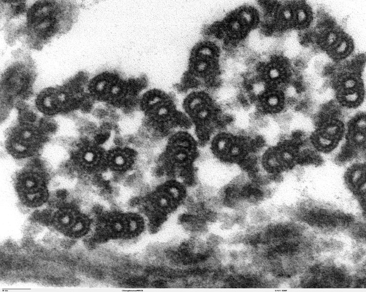 Soubor:Chlamydomonas TEM 17.jpg