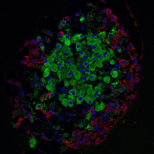 Soubor:Pancreaticislet.jpg